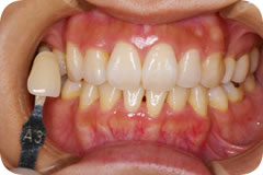 Before