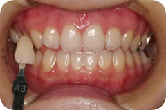 Before